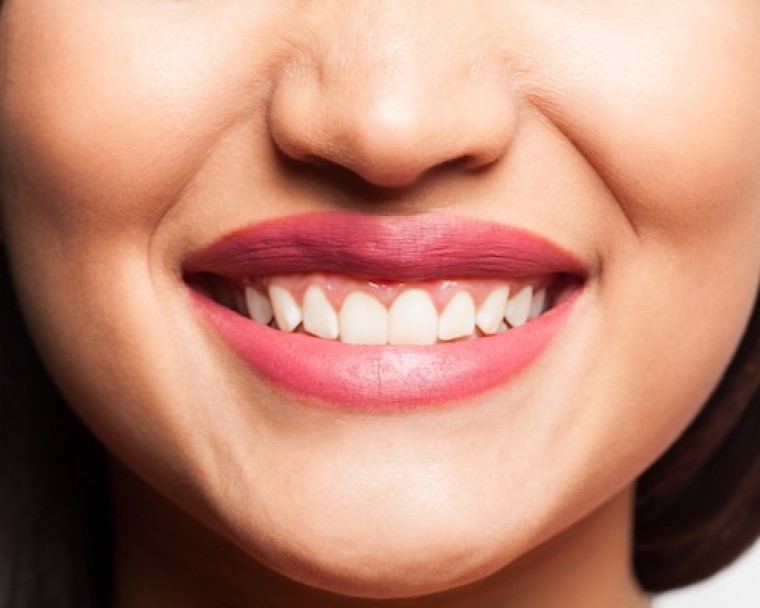 Complementary Smile Transformation Treatments